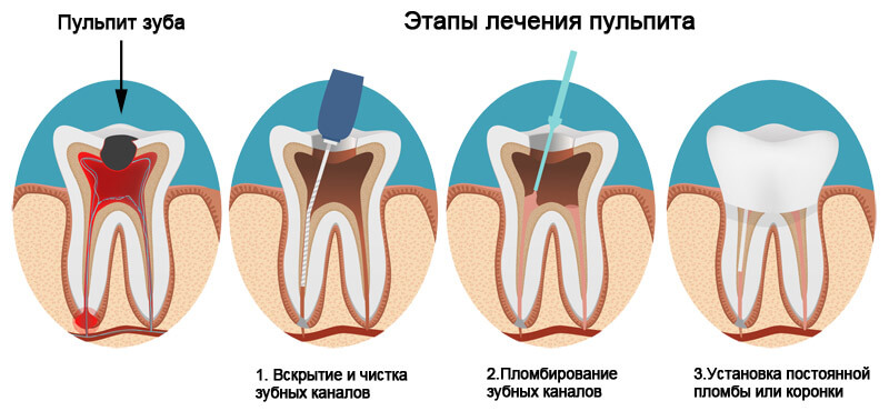 Лечение каналов Томск Новоселов Лечение зубов Томск Дальний